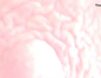 يحصل مارس الجنس منتفخ البطن البطن بواسطة الضباب الأحمر